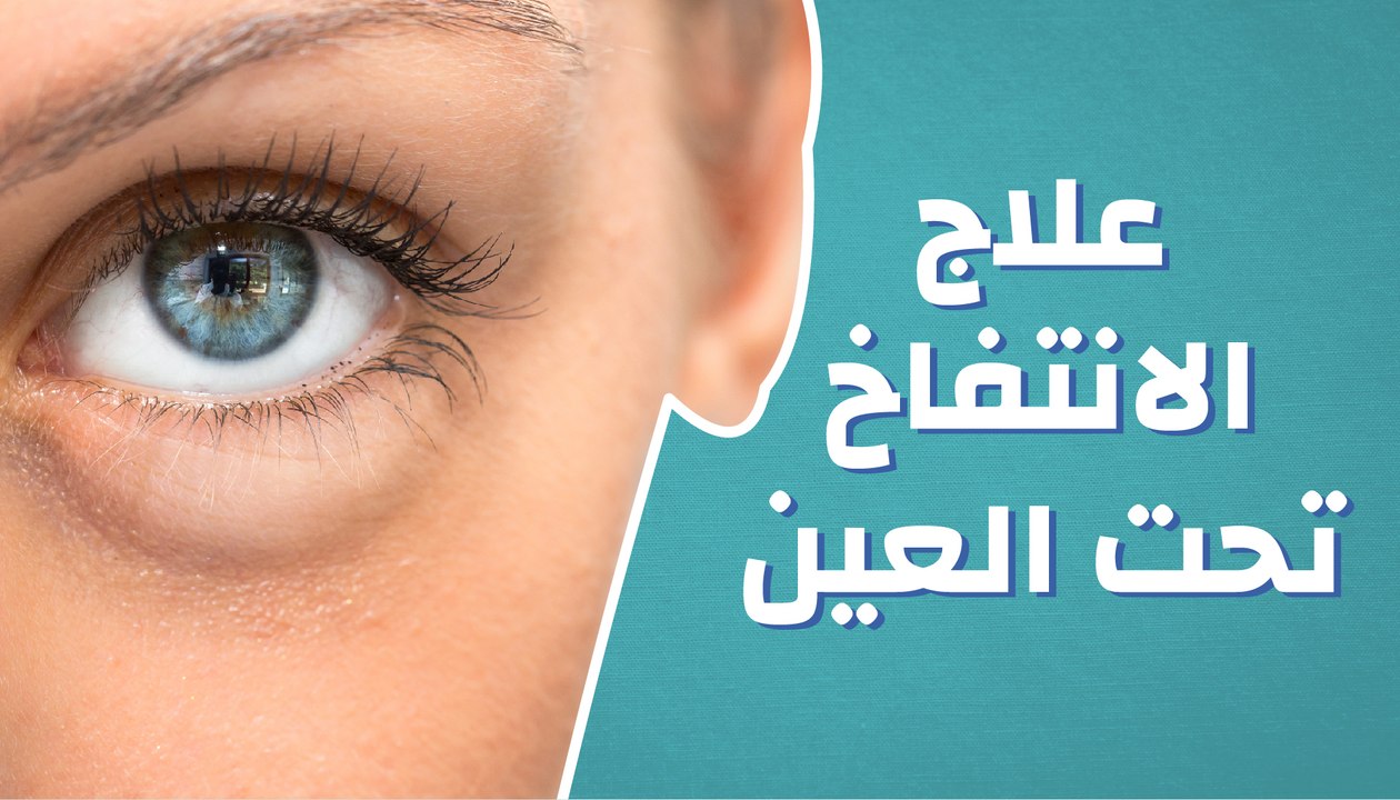 انتفاخ أسفل العين