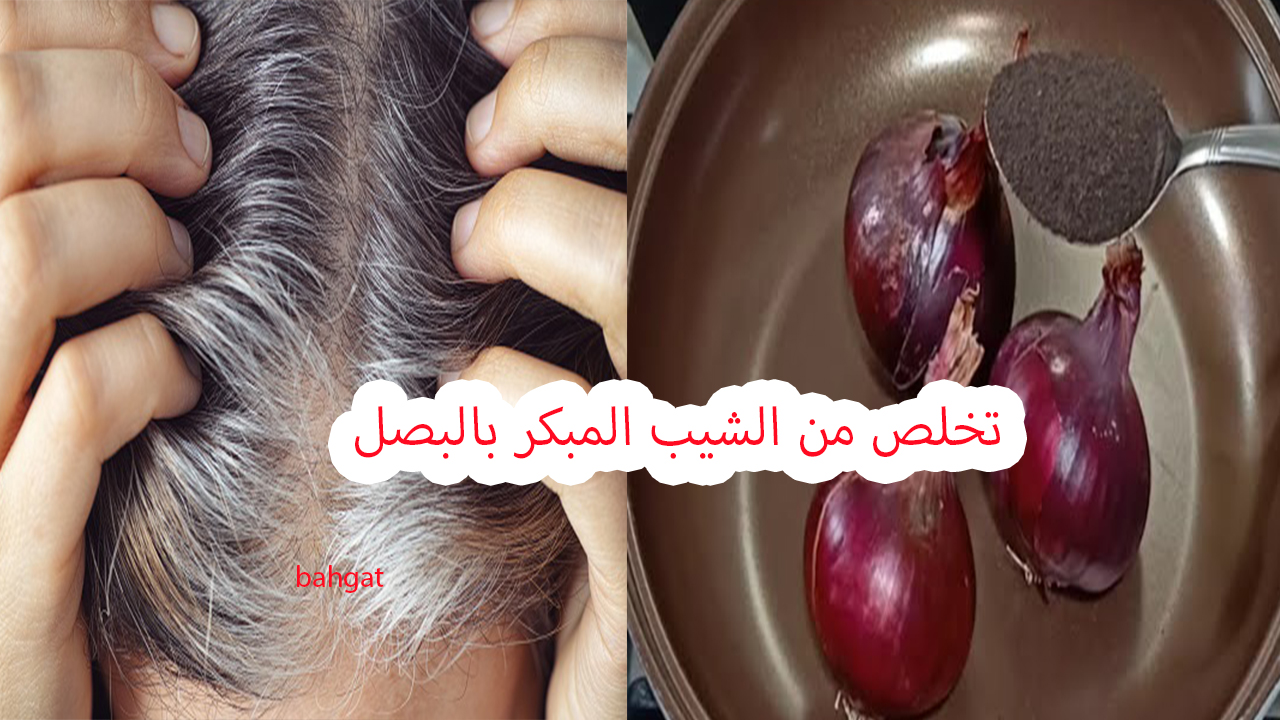 بالبصل تخلص من الشعر الأبيض
