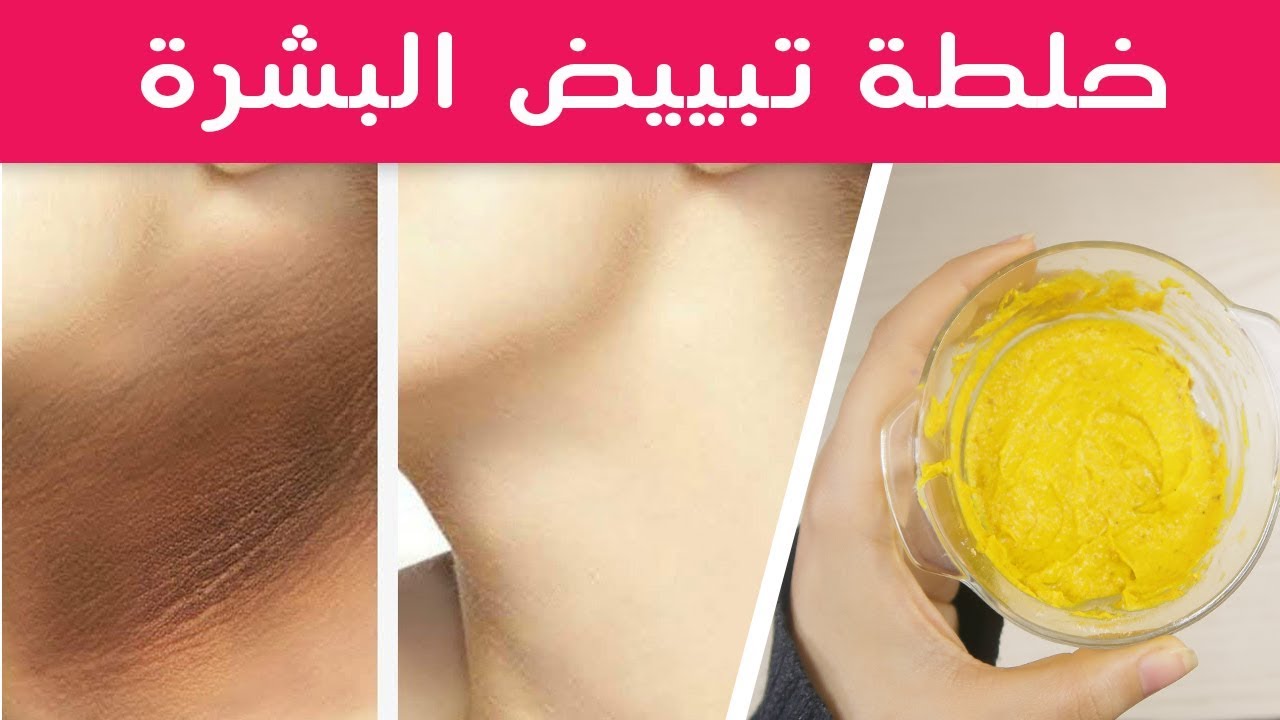 تبيض الرقبة