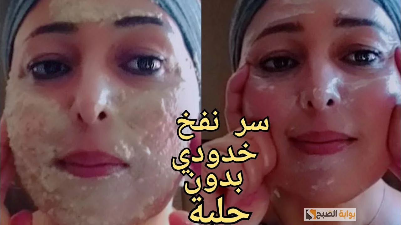 تسمين الخدود وزيادة إنتاج الكولاجين الطبيعي