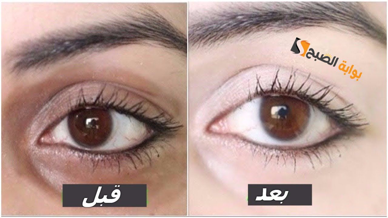 قولي وداعا الهالات.. وصفة ممتازة من العرقسوس لإزالة الهالات السوداء والاسمرار حول العين "عيونك هتقلب قلبين من جمالها"
