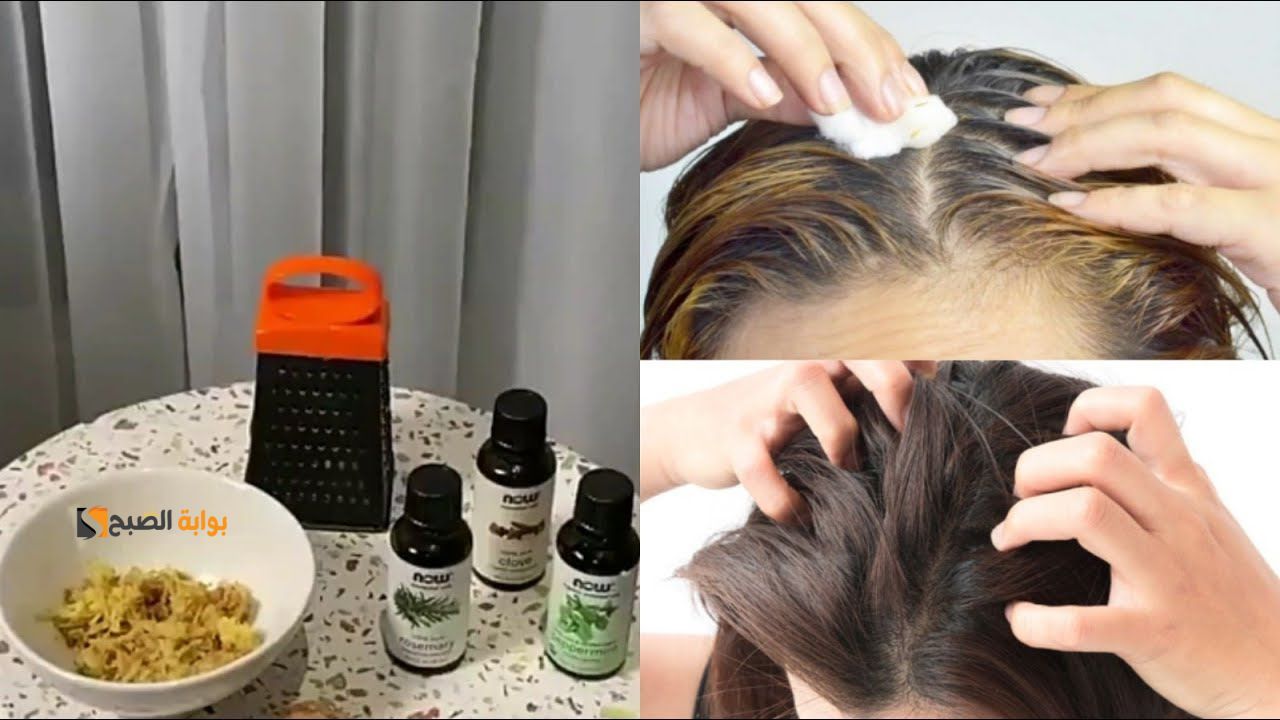 حتى لو حالته أدهورت.. قناع القرنفل وإكليل الجبل لمنع تساقط الشعر وزيادة كثافته "مش هيتربط من تقله"