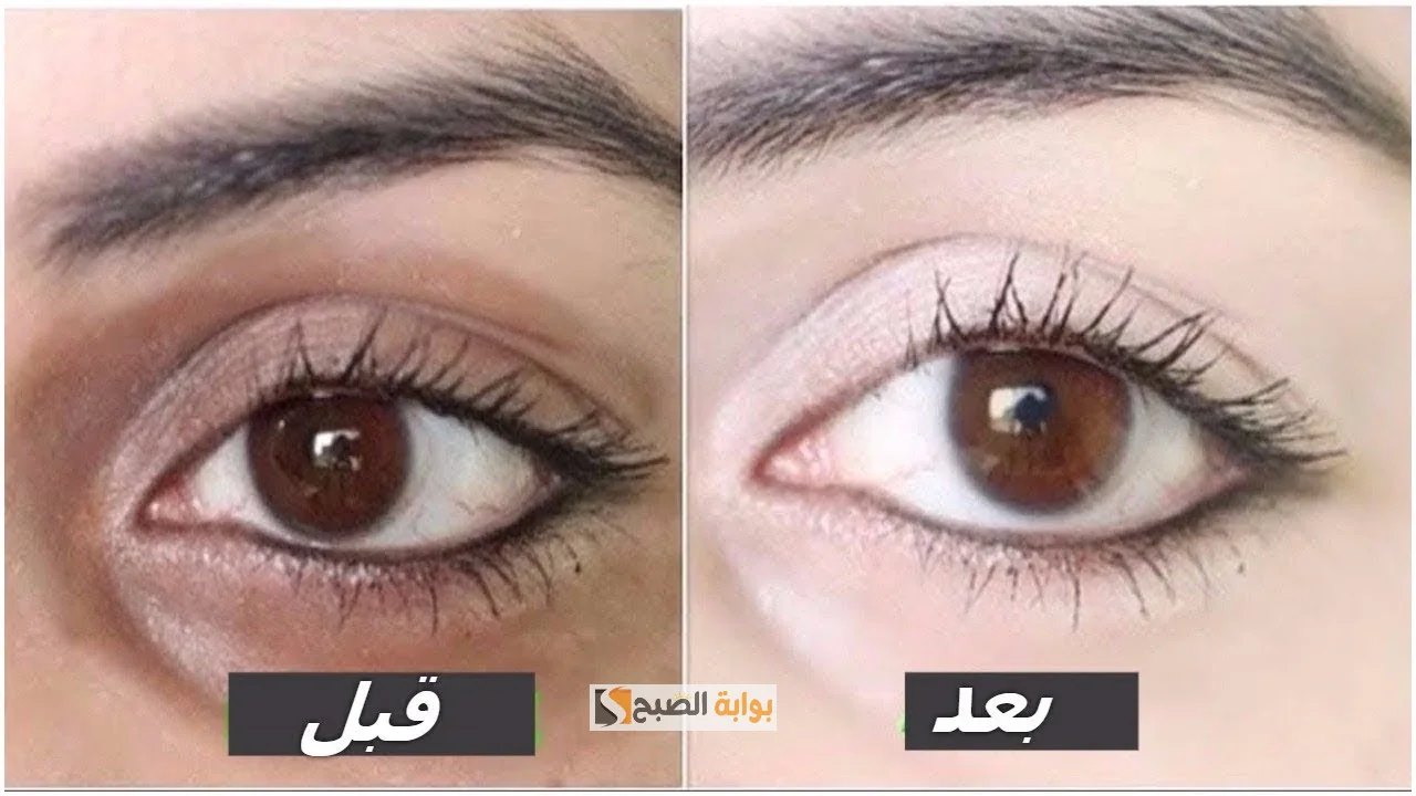 تفتيح الهالات السوداء