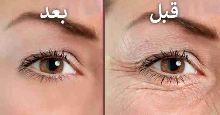 سيروم ازالة الهالات السوداء