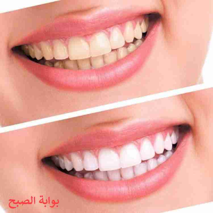 صنع بودرة تبيض الاسنان وغسول الفم