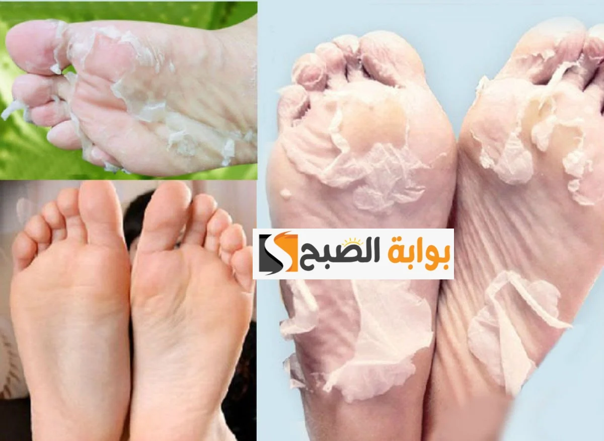 طريقة عمل كريم الخيار للتخلص من تشققات القدمين واليدين