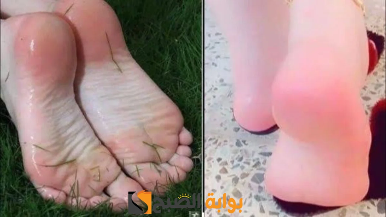 طريقة عمل مقشر طبيعي للقدمين