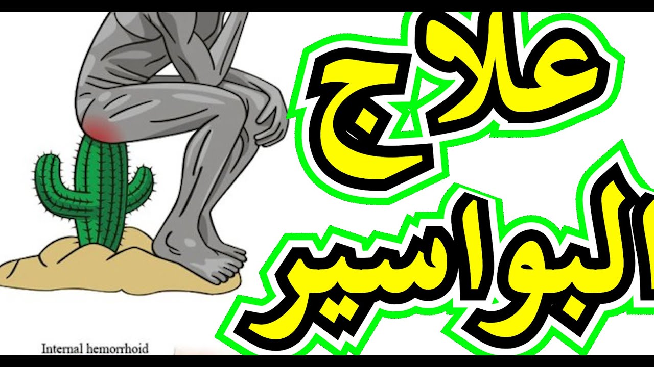 علاج البواسير