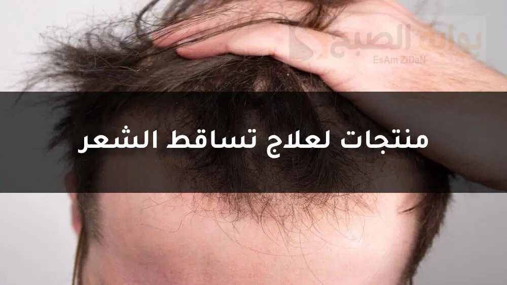 علاج تساقط الشعر للرجال وتكثيفه بالأعشاب وما الأسباب ال. 1