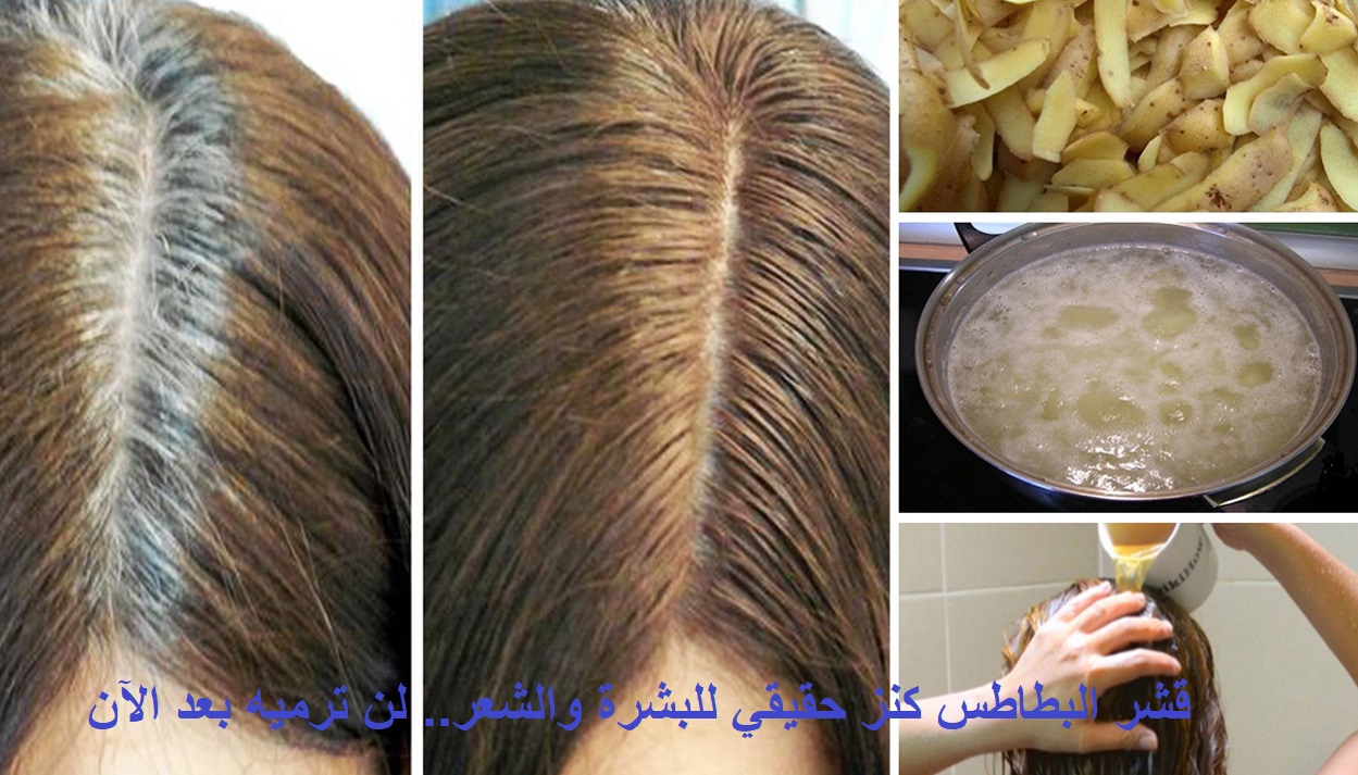 التخلص من الشيب
