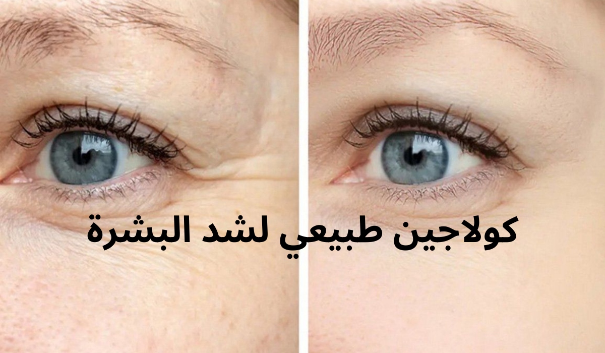كولاجين طبيعي لشد البشرة