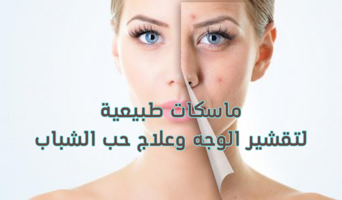 ماسكات طبيعية لتقشير الوجه وعلاج حب الشباب