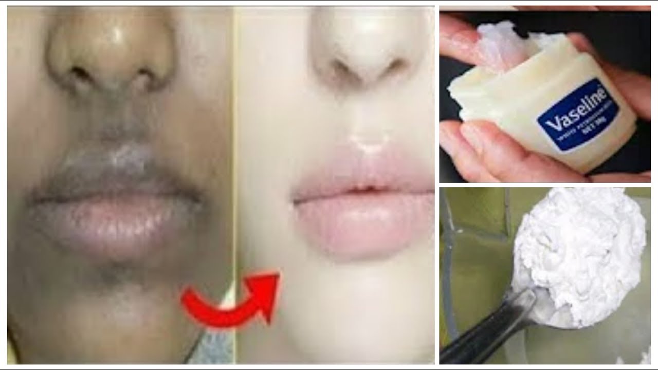 مكونات كريم الفازلين والنشا 1 1