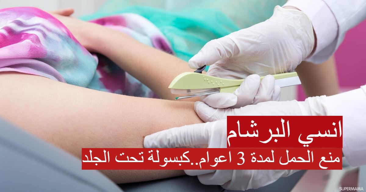 مميزات وعيوب استعمال كبسولة تحت الجلد لمنع الحمل 1