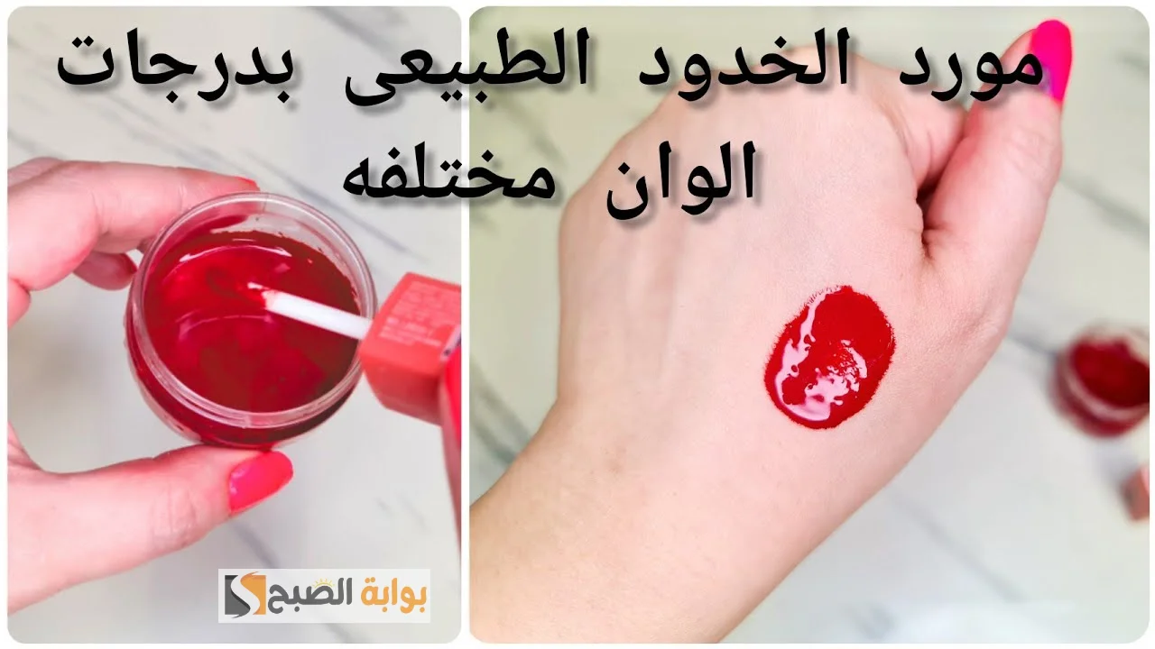 مورد الخدود والشفايف