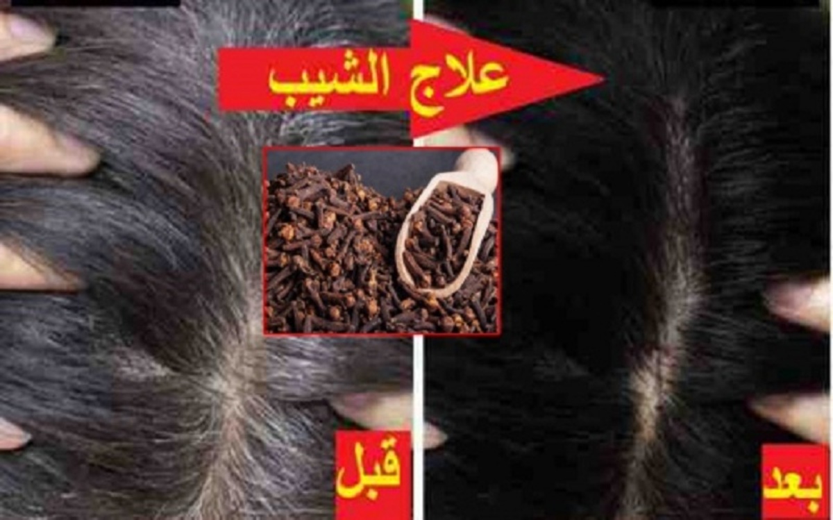 علاج الشيب للأبد