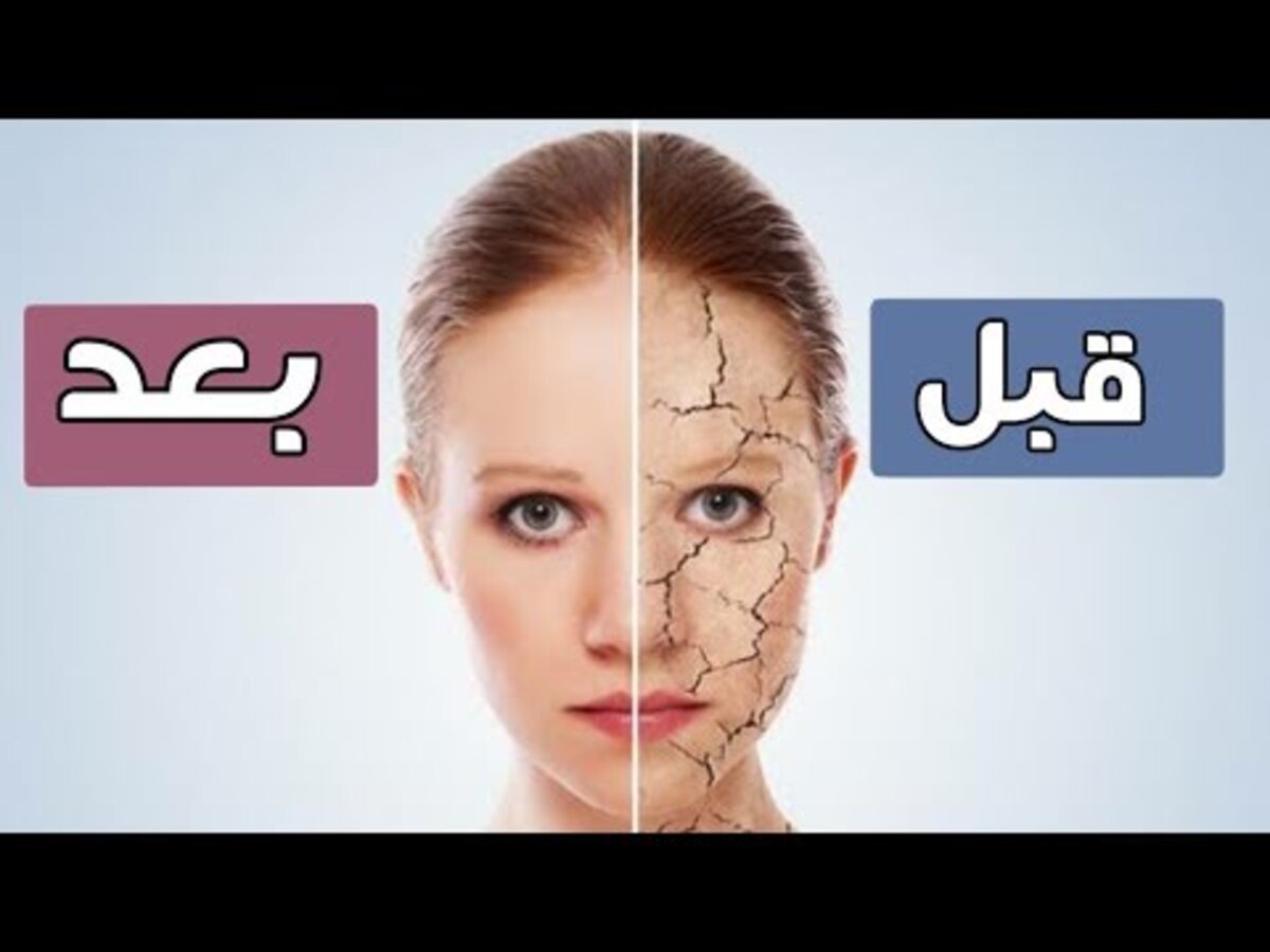 جفاف البشرة
