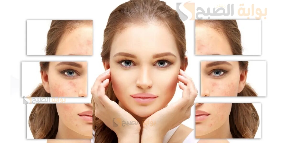 وصفات طبيعية سهلة وسريعة لتخلص من تصبغات البشرة