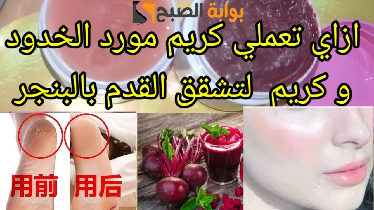 وصفة البنجر لتشققات القدمين