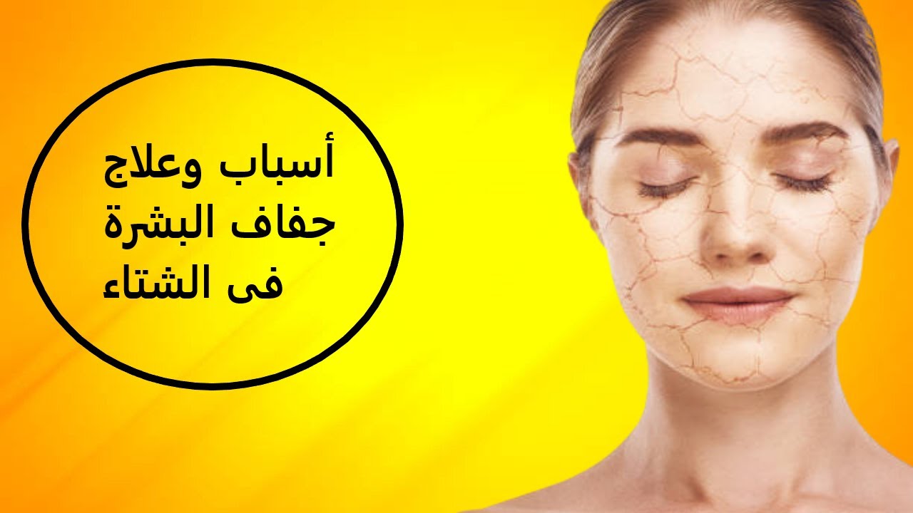 وصفة التخلص من جفاف البشرة في الشتاء