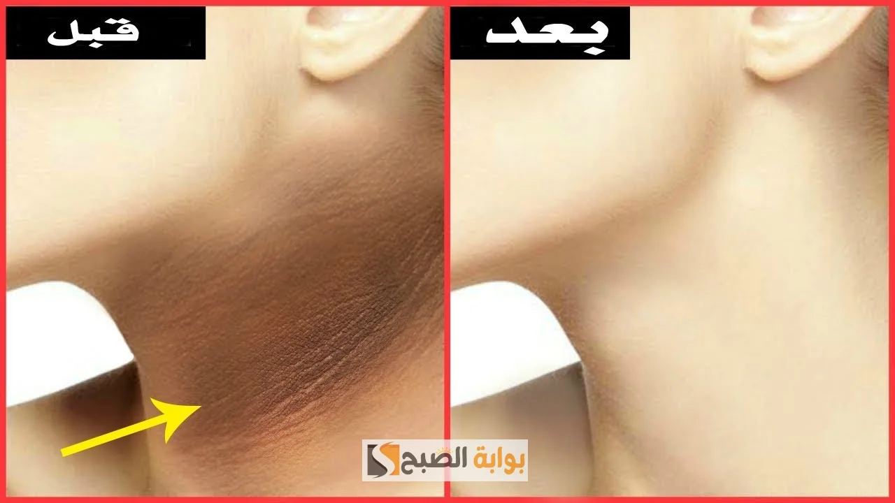 وصفة تبييض الرقبة بالنشا وعصير البرتقال