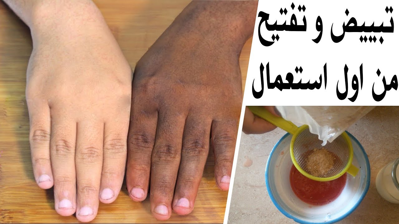 وصفة تبييض اليدين
