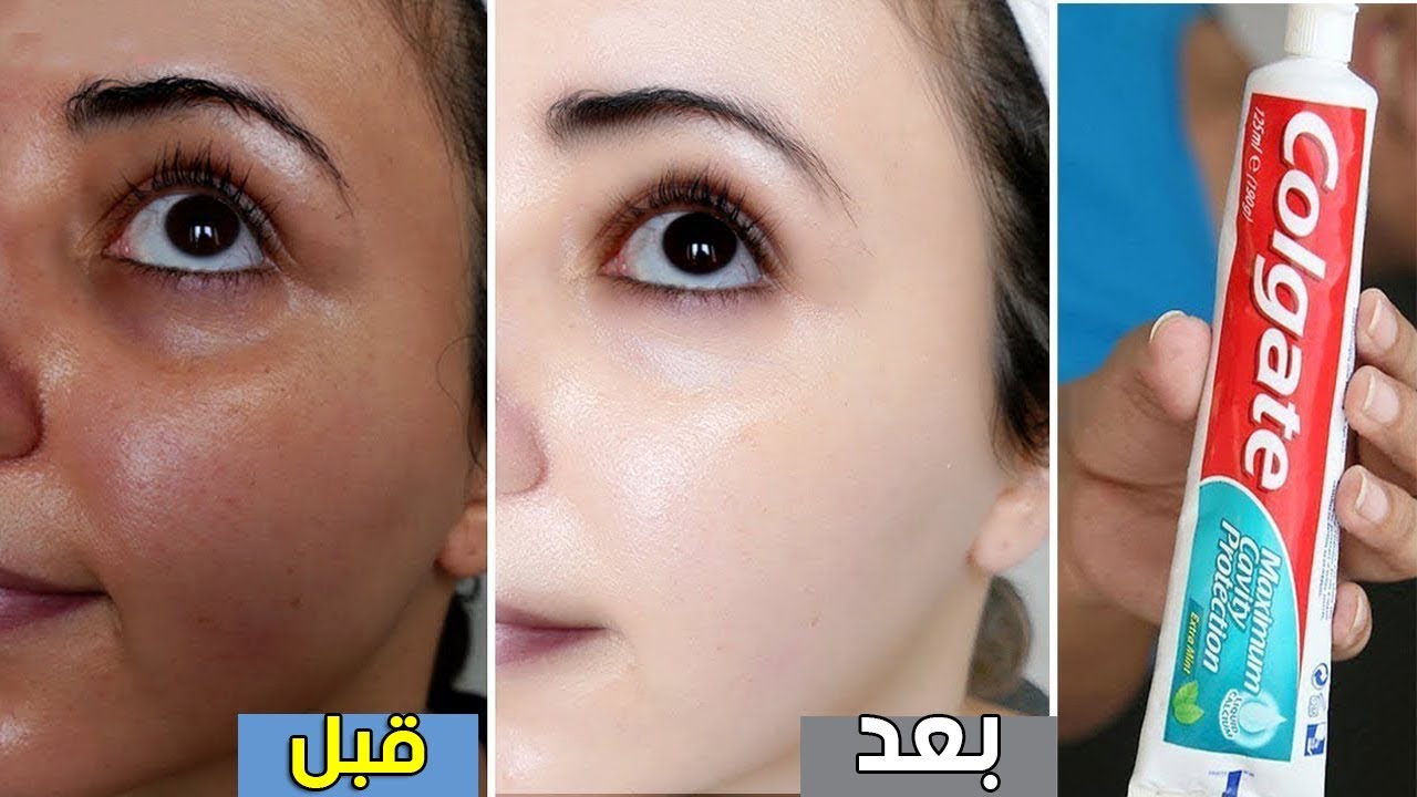 وصفة معجون الاسنان والنشا لبشرة بدون تجاعيد ولا تصبغات