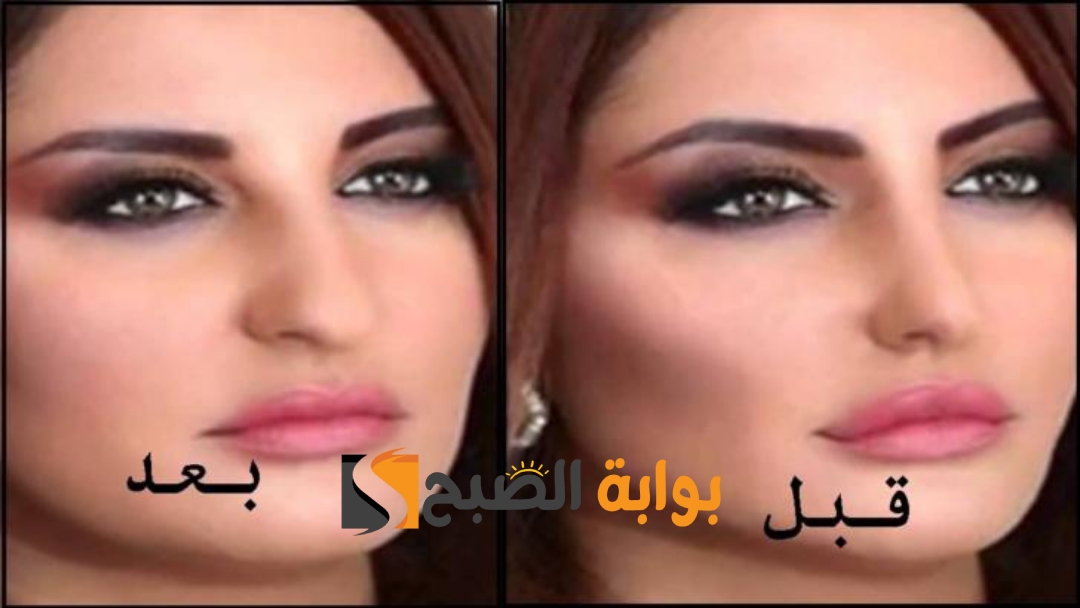 وصفة لتسمين الخدود