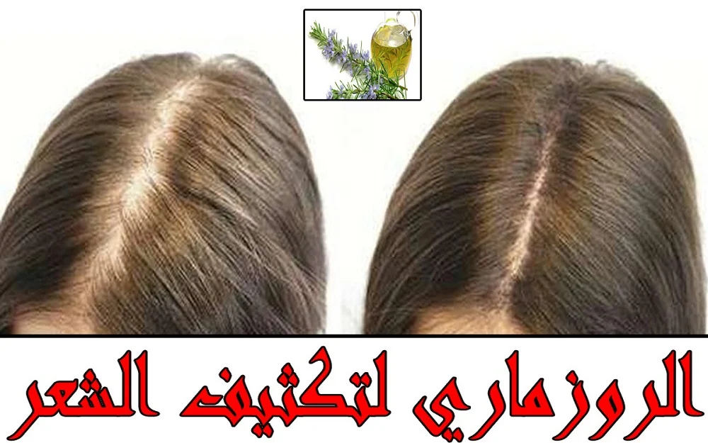 وصفات البنجر والروزماري لتنعيم وتطويل الشعر