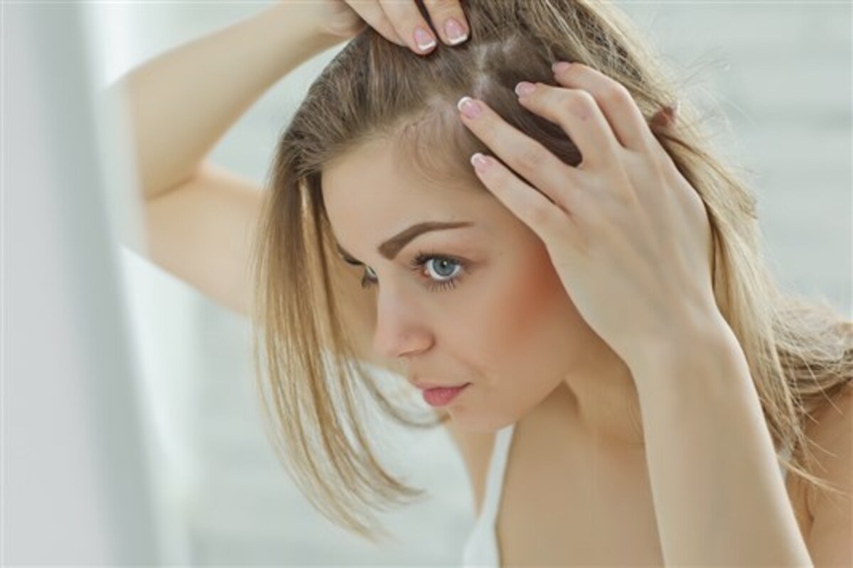 وصفات للتخلص من تساقط شعر الجانبين