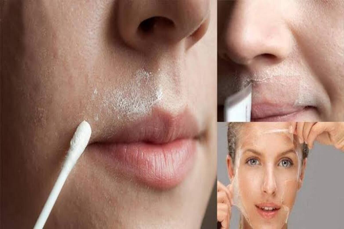وصفات طبيعية لإزالة شعر الوجه