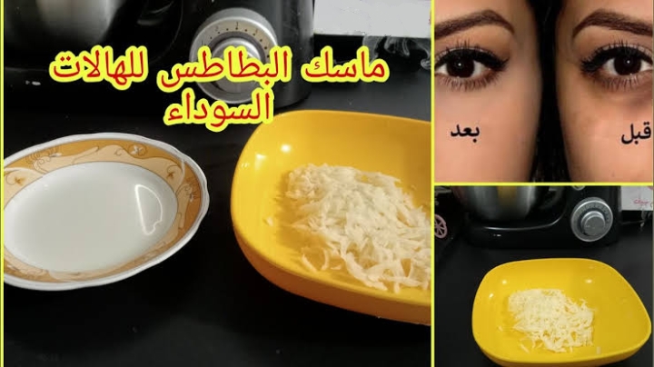 قناع البطاطس للتخلص من الهالات السوداء