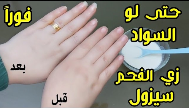 وصفة الحليب لتبييض اليدين