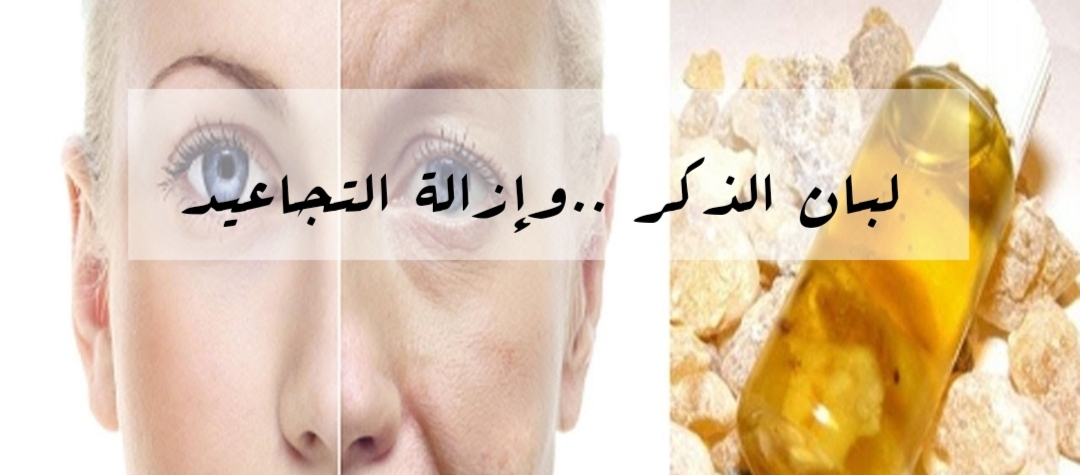 IMG ٢٠٢٤٠٢١٣ ٢٢٤٢٤٤