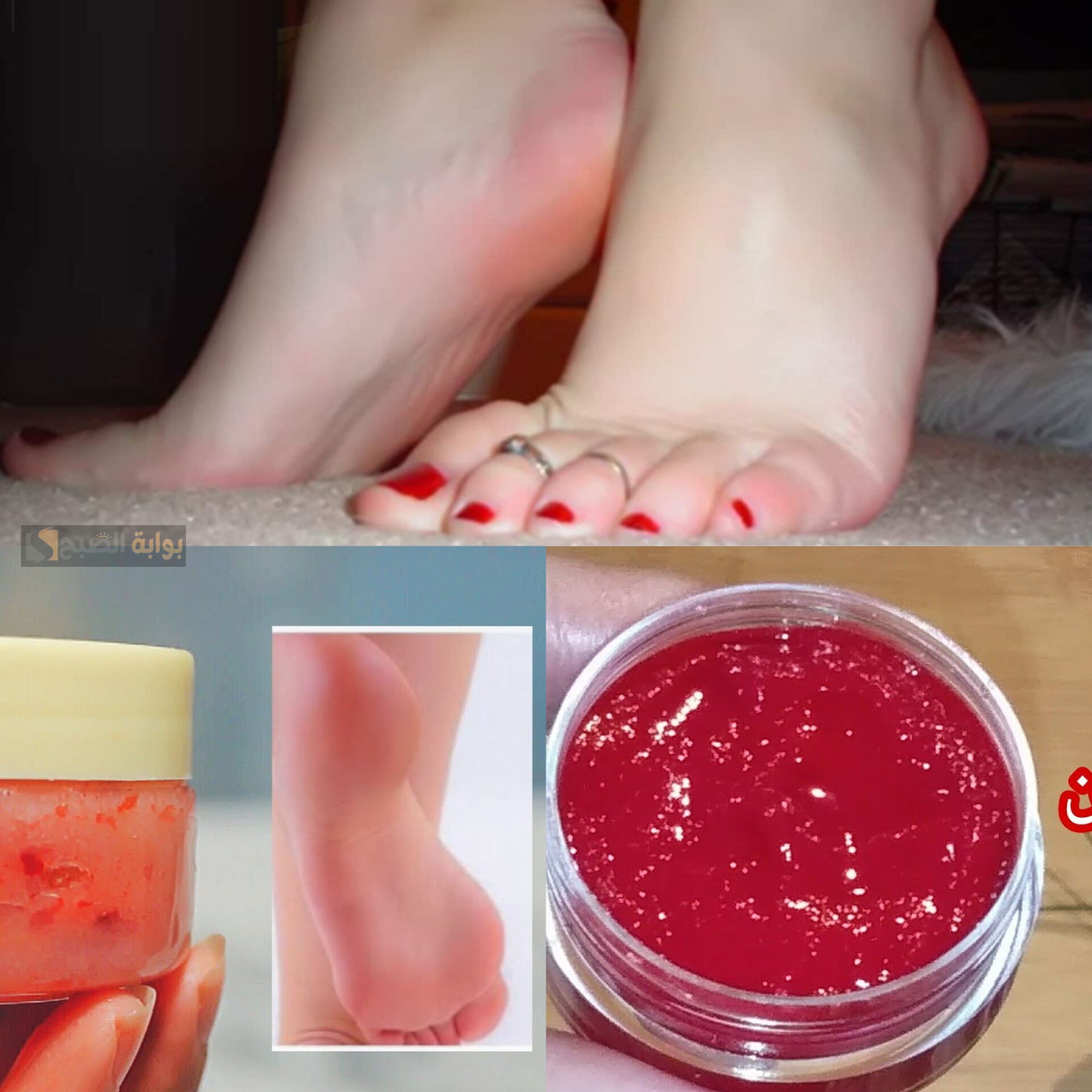 5 طرق التخلص من تشققات القدم