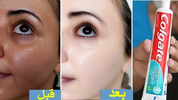 كريم معجون الأسنان والجبنة