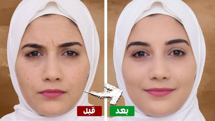 وصفة الكركم والفازلين للبشرة