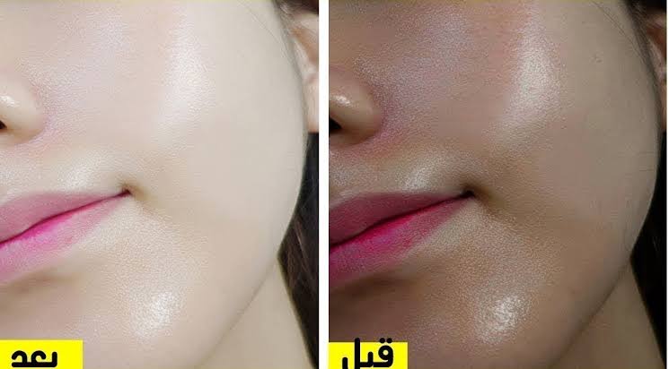 وصفة الخميرة للتخلص من الاسمرار