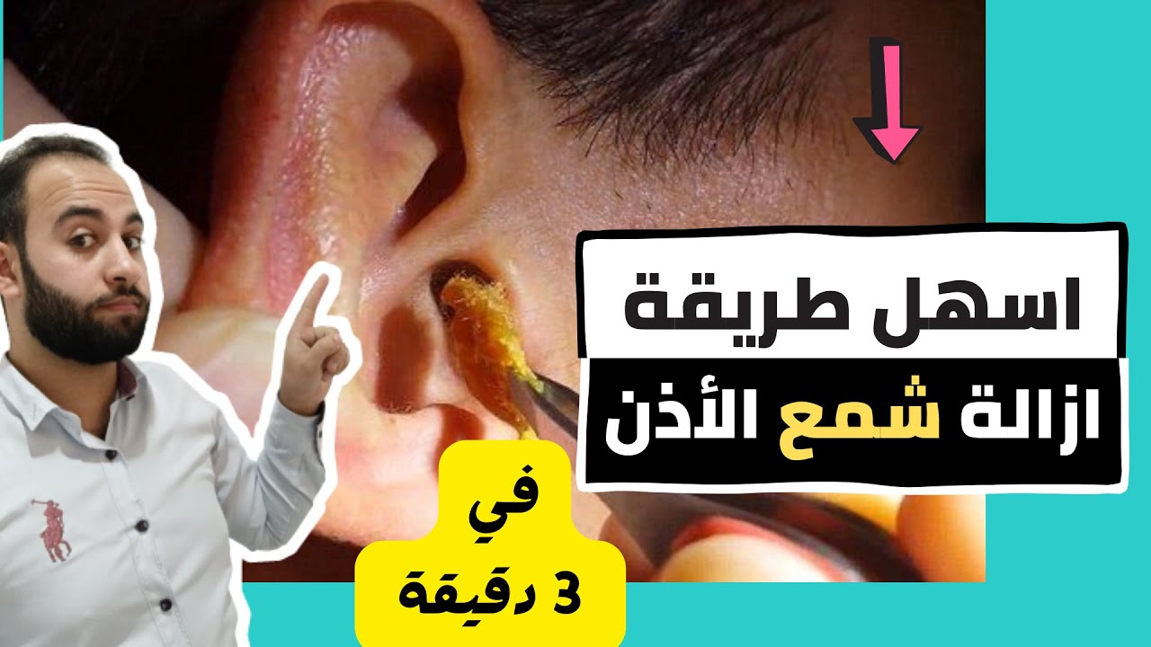تنظيف الأذن من الشمع فى المنزل بدون دكتور