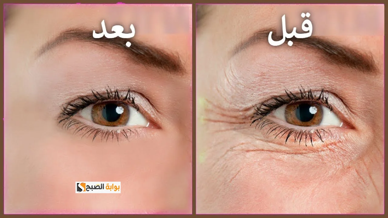 أفضل كولاجين طبيعي لإزالة التجاعيد
