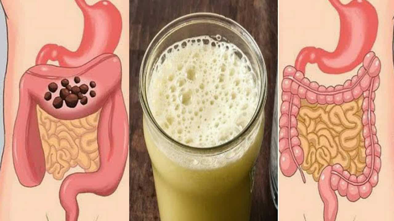 أقوي مشروبات طبيعية لتنظيف القولون والتخلص من الفضلات خلال أيام1