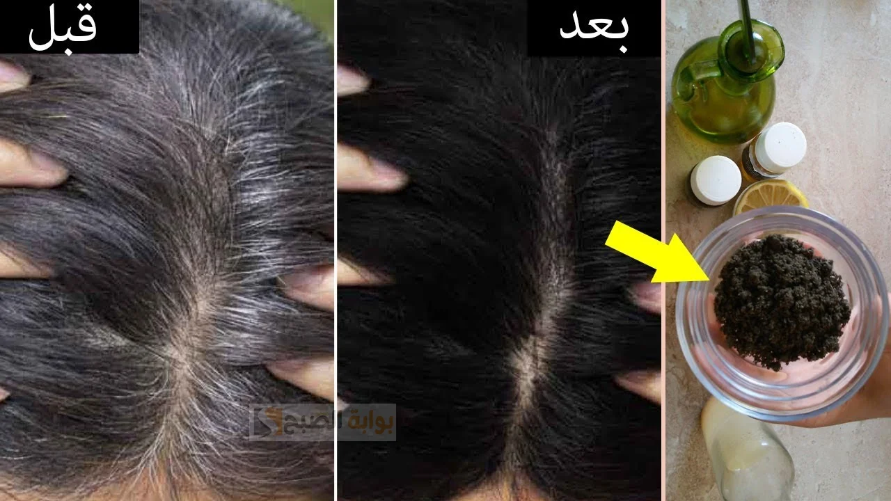 طريقة لإزالة الشعر الأبيض