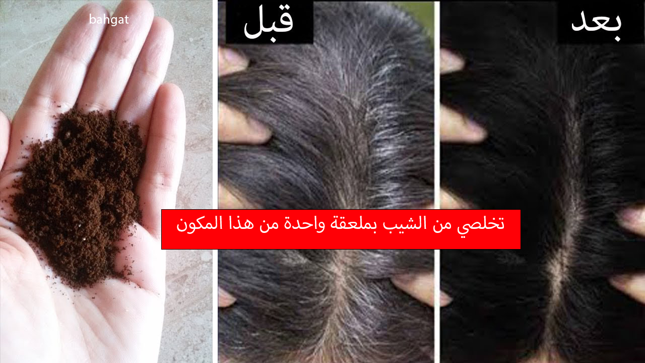 التخلص من الشيب والشعر الأبيض