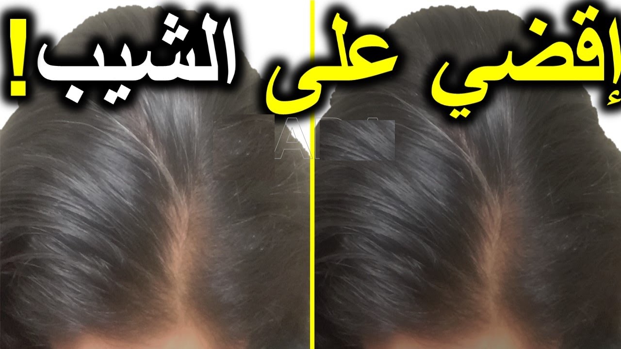 التخلص من الشيب