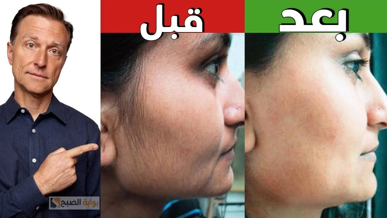 الشعر الزائد في الوجه