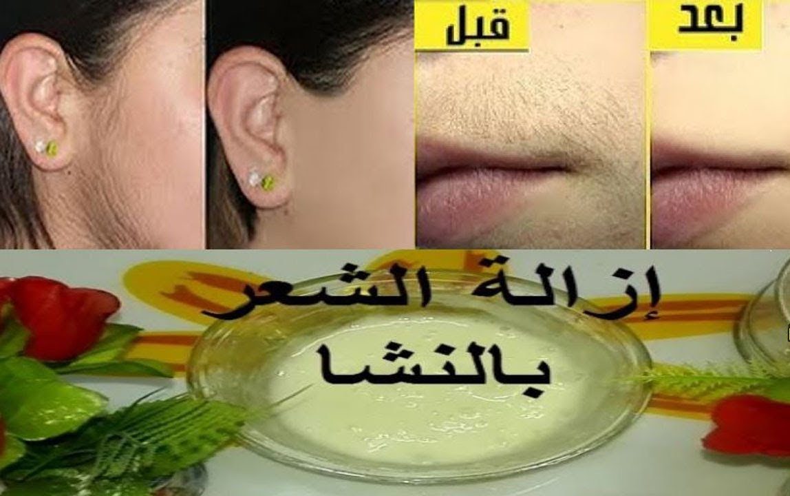 النشا والسكر لإزالة شعر الوجه والجسم كله 1