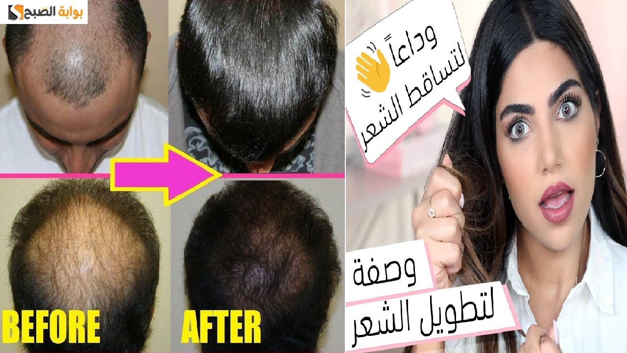 تجارب الثوم للشعر1