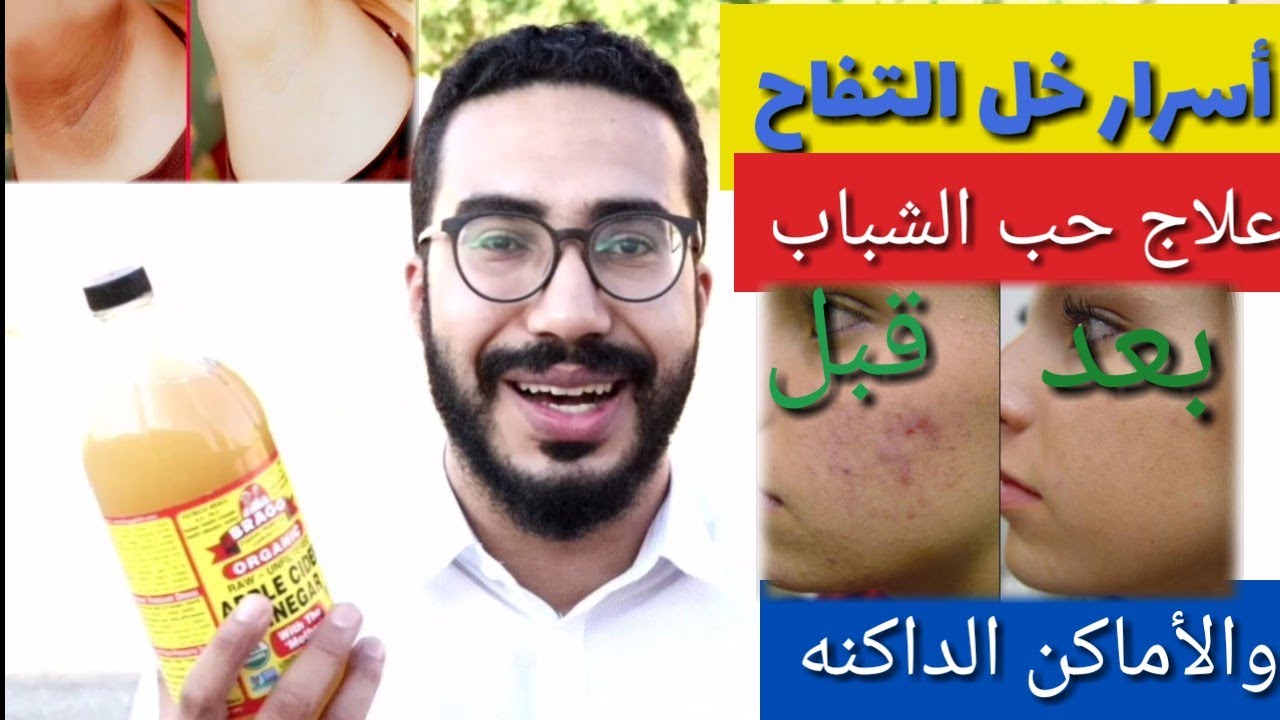 استخدامات خل التفاح للبشرة