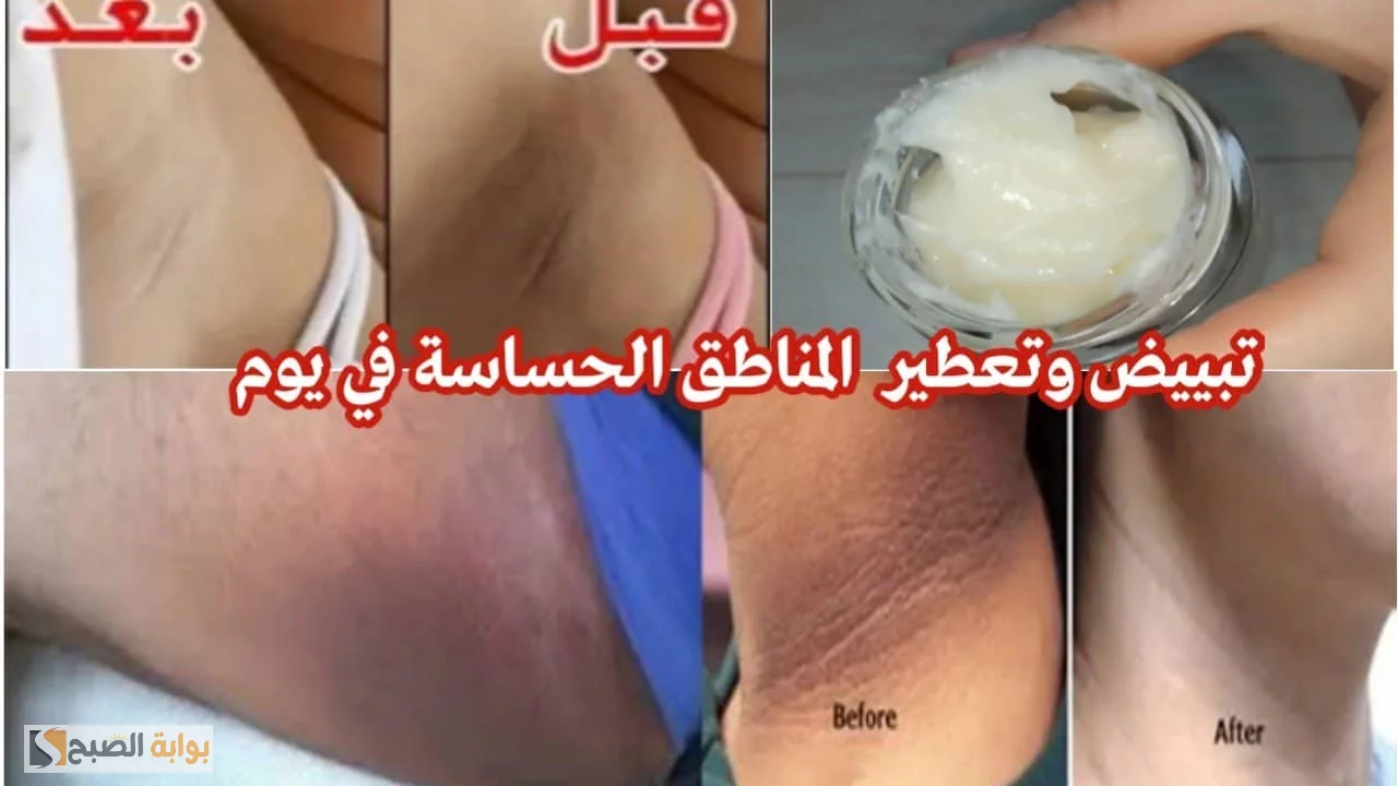 تفتيح الجسم وإزالة الاسمرار من المناطق الحساسة 1