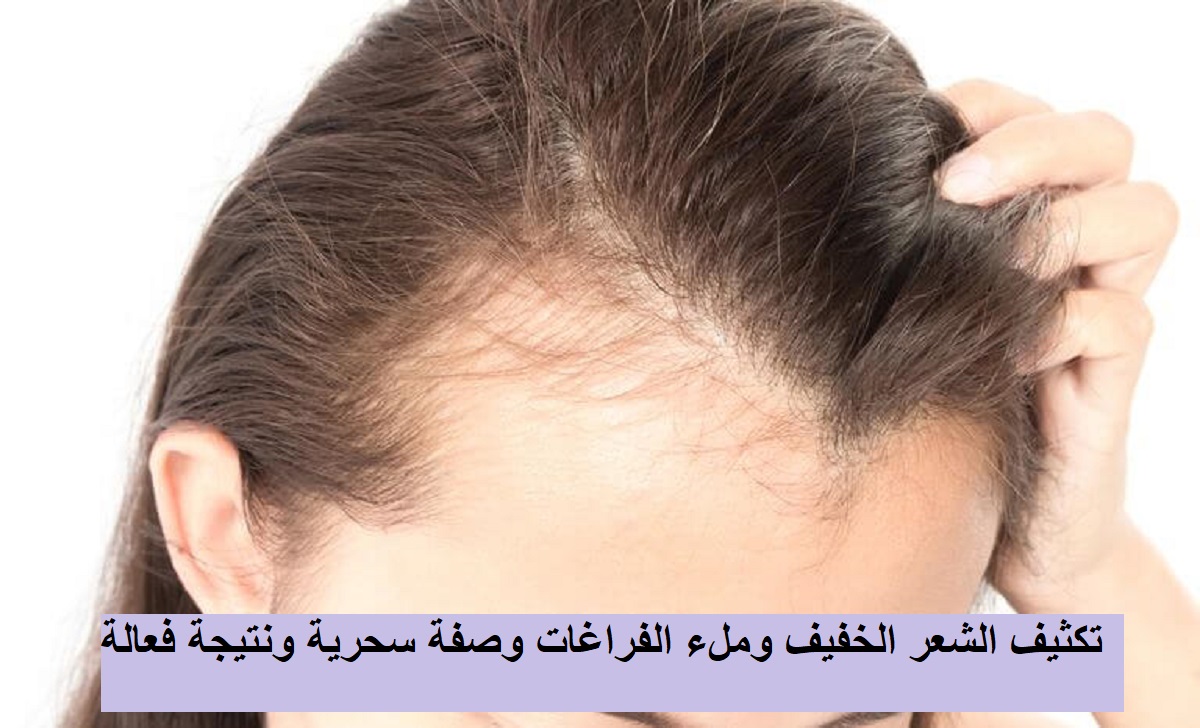 تكثيف الشعر الخفيف وملء الفراغات